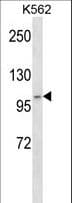 ADAMTS5 Antibody (aa26-54)