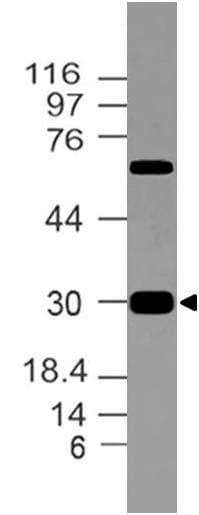 Polyclonal Rabbit anti-Human POMC / Proopiomelanocortin Antibody (WB)