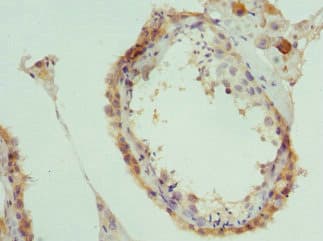PAICS / ADE2 Antibody