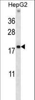 Polyclonal Rabbit anti-Human HMGN1 / HMG14 Antibody (aa1-30, IHC, WB)