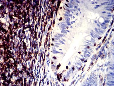 ITGAL / CD11a Antibody (clone 5G7C5)