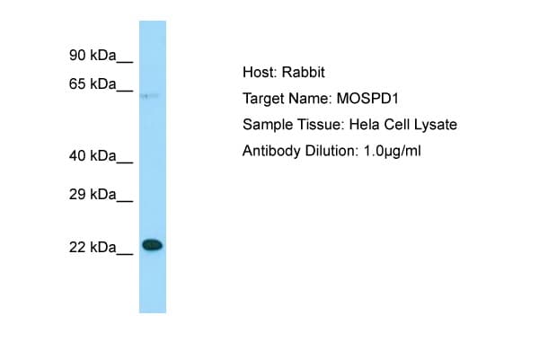 MOSPD1 Antibody (N-Terminus)