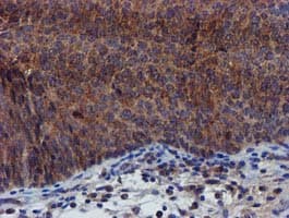 PYCRL Antibody (clone OTI3E1, Carrier-free)