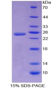 Human A1CF / ACF Protein (Recombinant His-T7)
