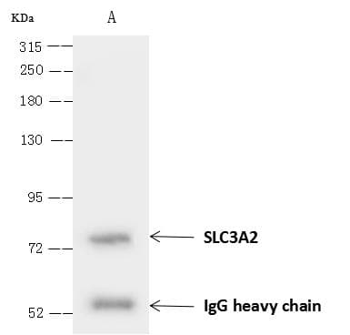 Polyclonal Rabbit anti-Human CD98 Antibody (Preservative Free, aa206-630, IHC, IF, WB)