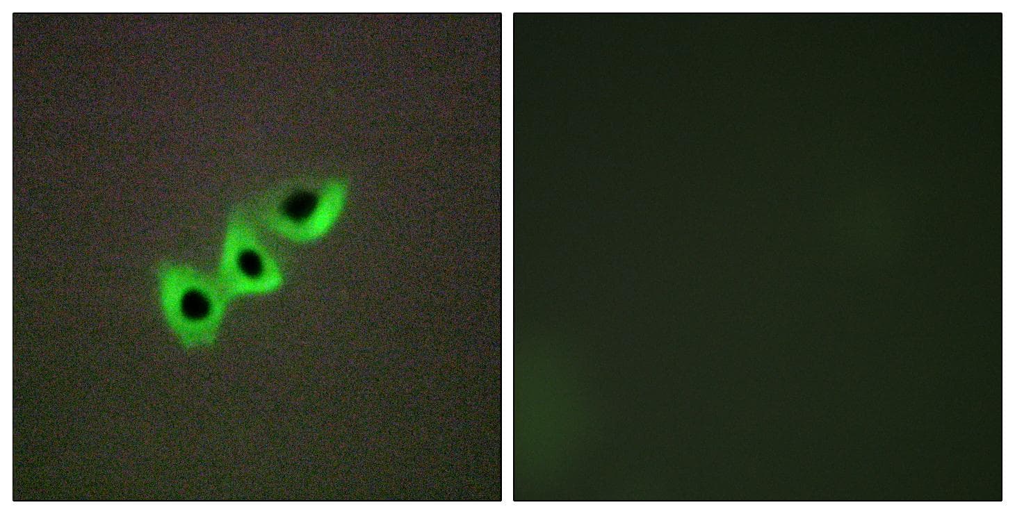 Polyclonal Rabbit anti-Human DLC1 Antibody (IHC, IF)
