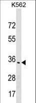 OR1F1 Antibody (aa275-303)