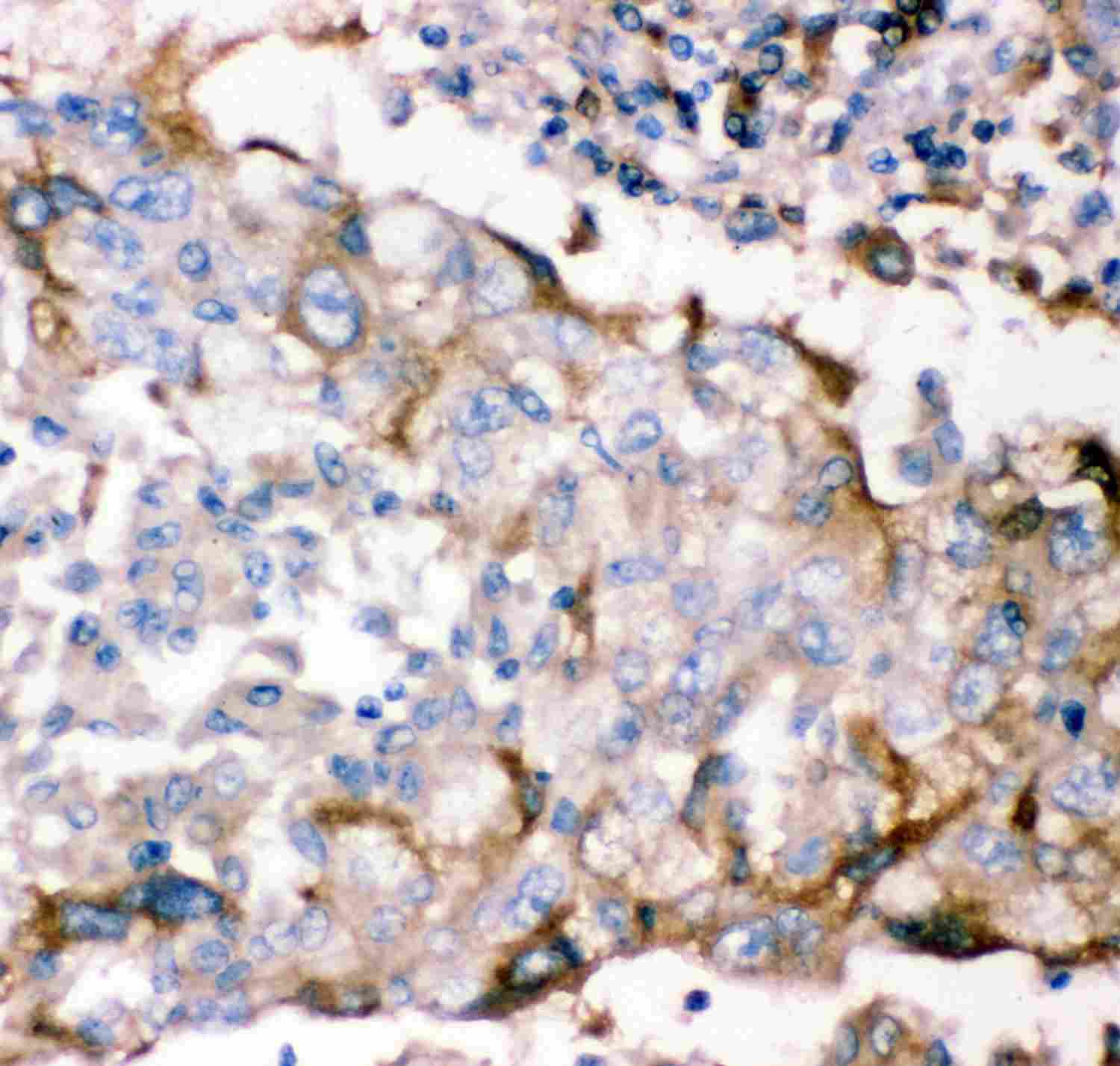 GFRA1 / GFR Alpha Antibody