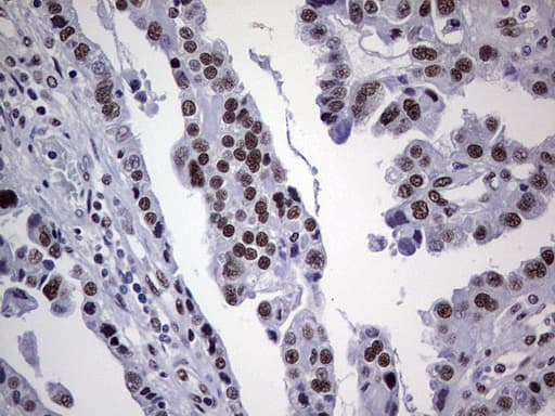 Monoclonal Mouse anti-Human PPP1R8 / Rnase E Antibody (clone OTI4E5, aa1-225, IHC, WB)