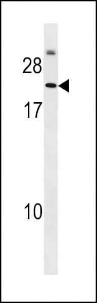PDPN / Podoplanin Antibody (aa33-63)