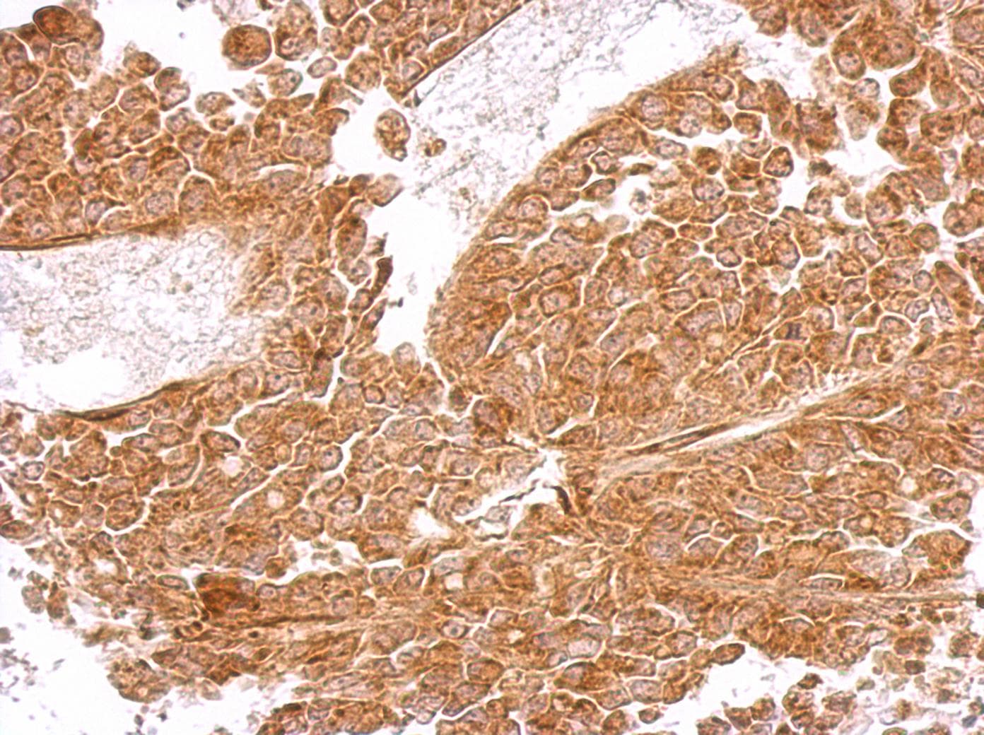 Polyclonal Rabbit anti-Human MRPS5 Antibody (aa1-430, IHC, WB)