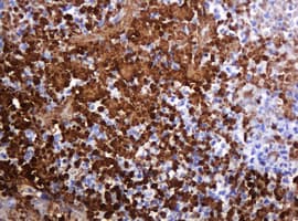 PARVB Antibody (clone OTI3G1)