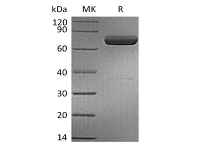 IL23A / IL-23 p19 Protein (Recombinant 6His, C-terminus)