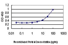 BARD1 Antibody (clone 2A11)
