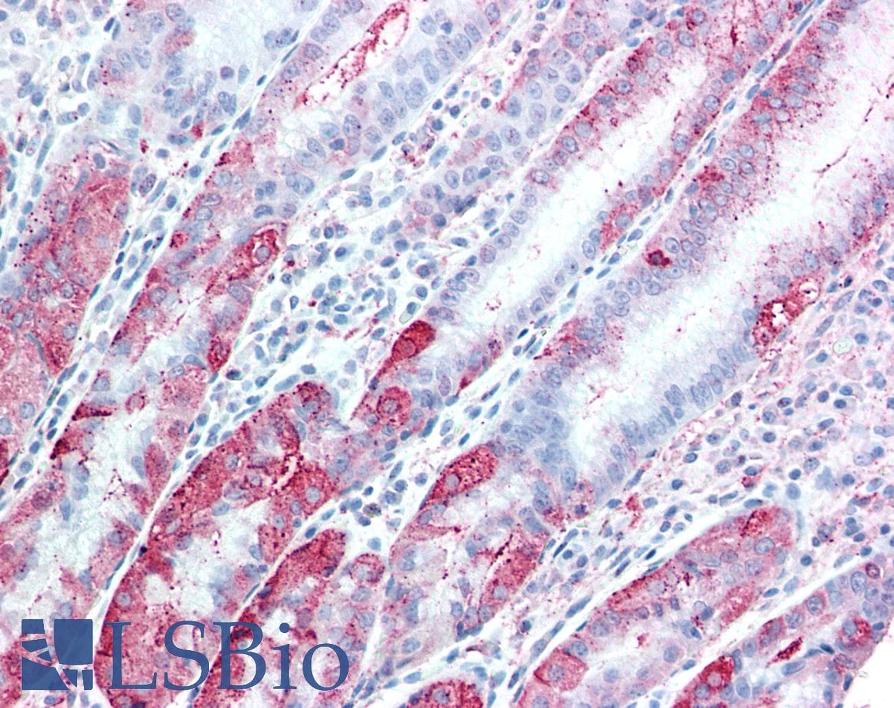 IHC-plus™ TSPAN13 / TM4SF13 Antibody (Internal)
