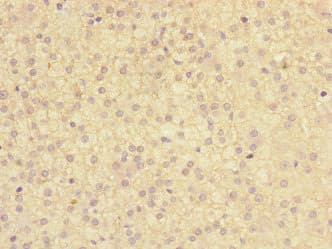 Polyclonal Rabbit anti-Human TMED1 / ST2L Antibody (IHC)