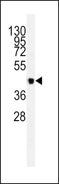 PathPlus™ VEGFC Antibody