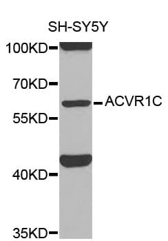 IHC-plus™ ACVR1C / ALK7 Antibody