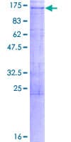 Human STARD8 Protein (Recombinant GST)