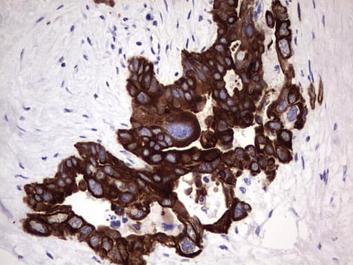 Monoclonal Mouse anti-Human KRT19 / CK19 / Cytokeratin 19 Antibody (clone OTI1F5, aa240-390, IHC, WB)