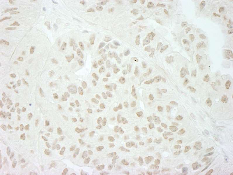 SFSWAP / SWAP Antibody (aa500-550)
