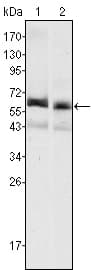 IHC-plus™ Monoclonal Mouse anti-Human Alpha-Fetoprotein Antibody (clone 6E6, IHC, WB)