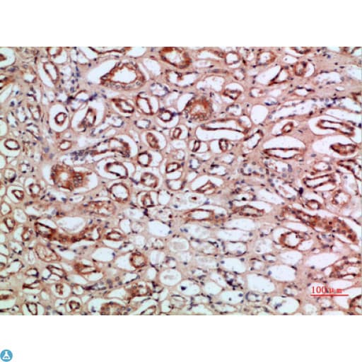 CLEC3B / Tetranectin Antibody