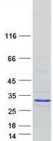 Human MBD3L5 Protein (Recombinant Myc-DDK (Flag))