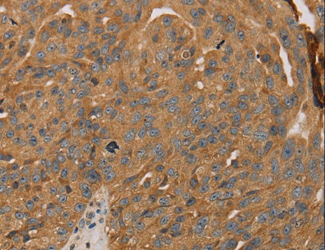 PARP11 Antibody