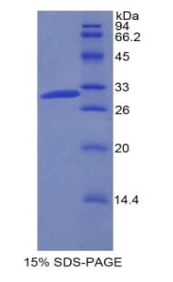 Mouse F5 / Factor Va Protein (Recombinant His)