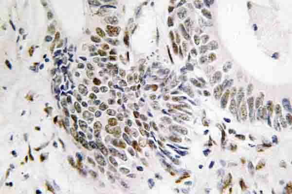 Polyclonal Rabbit anti-Human RAD51 / RECA Antibody (Thr309, IHC, WB)