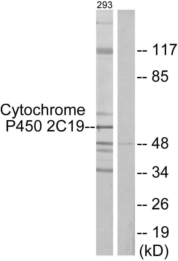 Polyclonal Rabbit anti-Human CYP2C19 Antibody (aa241-290, WB)