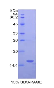 Human LAIR2 / CD306 Protein (Recombinant His)