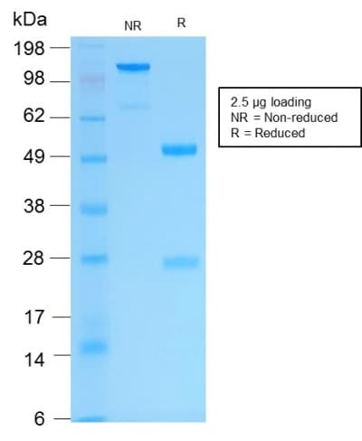 Recombinant Monoclonal Rabbit anti-Human KRT16 / CK16 / Cytokeratin 16 Antibody (clone KRT16/2043R, C-Terminus, IHC)
