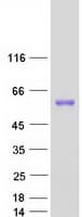 Human TBCEL / E-Like Protein (Recombinant Myc-DDK (Flag))