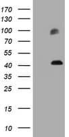 MAGEA3 Antibody (clone OTI1A10)