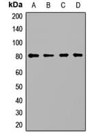 Polyclonal Rabbit anti-Human PCCA Antibody (WB)