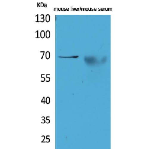 Alpha-Fetoprotein Antibody (361-410 aa, Internal)
