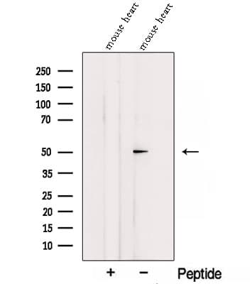 Polyclonal Rabbit anti-Human SGMS1 / TMEM23 Antibody (WB)