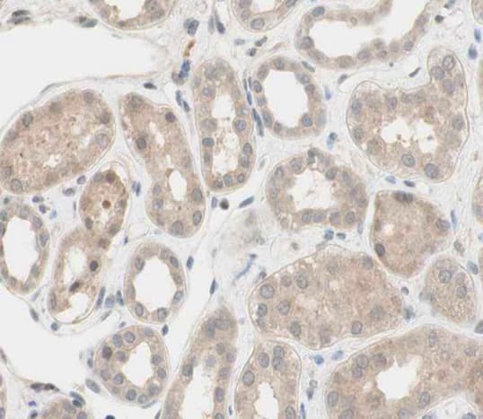 Polyclonal Rabbit anti-Human FGFR2 / FGF Receptor 2 Antibody (IHC, WB)