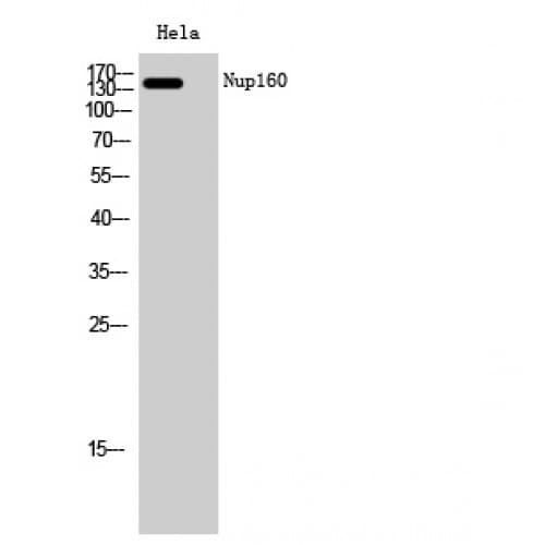 NUP160 Antibody (370-450 aa, Internal)