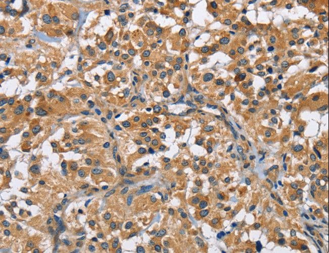 CD135 / FLT3 Antibody