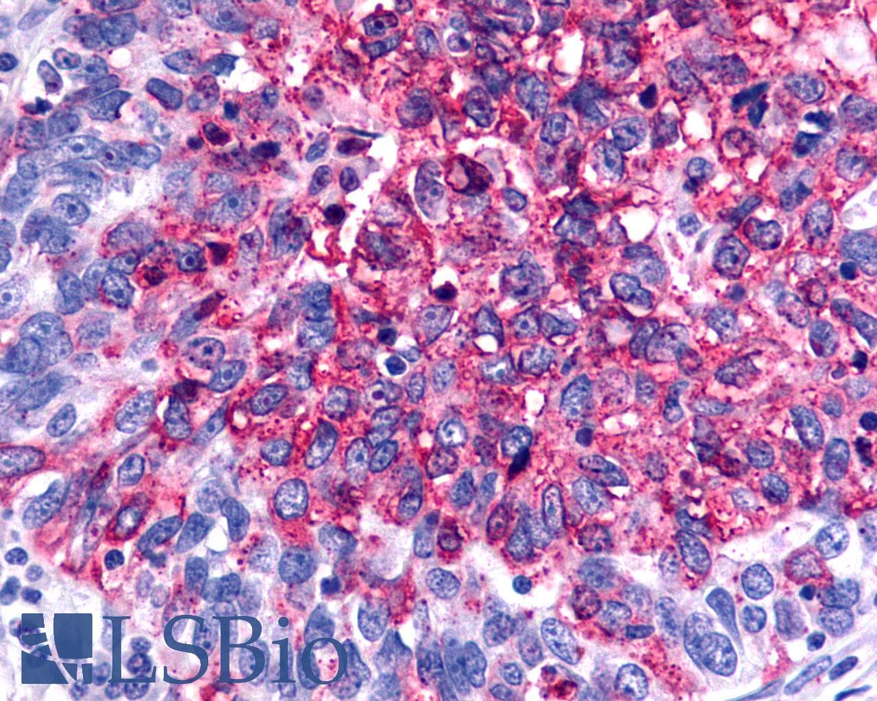 PathPlus™ GALR2 / Galanin Receptor 2 Antibody (C-Terminus)