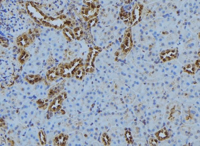 CASQ2 / Calsequestrin 2 Antibody