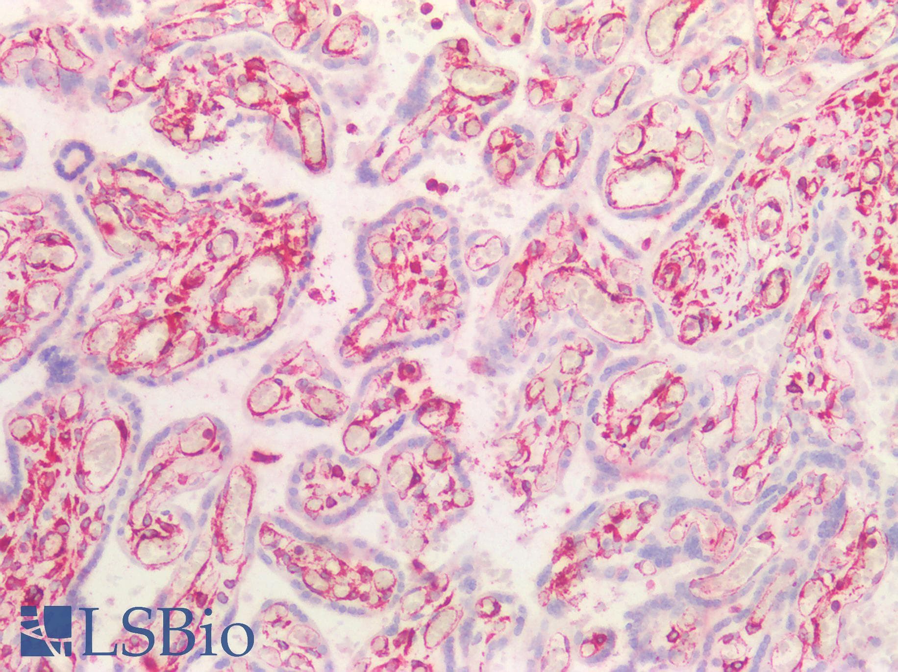 PathPlus™ Vimentin Antibody