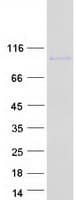 Human EPB41L5 Protein (Recombinant Myc-DDK (Flag))