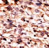 CREB1 / CREB Antibody (phospho-Ser133)