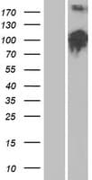LLGL2 Protein (Over-Expression Lysate Myc-DDK (Flag))