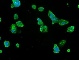 IHC-plus™ Monoclonal Mouse anti-Human SLC7A8 / LAT2 Antibody (clone 4H10, IHC, IF)