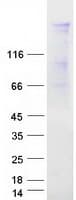 Human FNBP4 Protein (Recombinant Myc-DDK (Flag))
